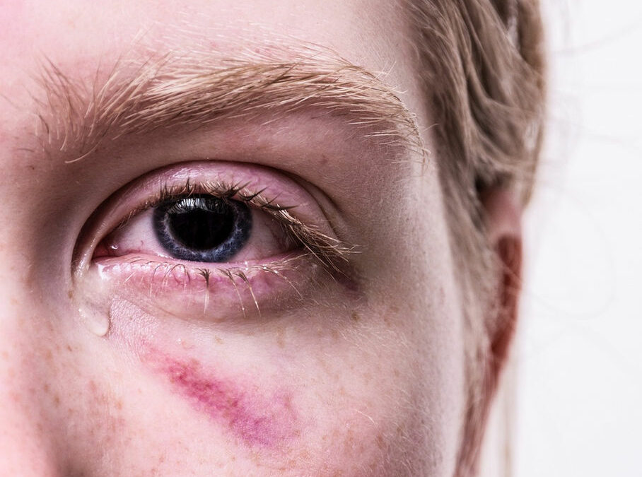 Victime d’agression: qu’est ce que l’ITT au sens pénal?