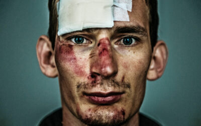 Victime d’un accident, je ne peux plus travailler comme avant: quels sont mes droits ?