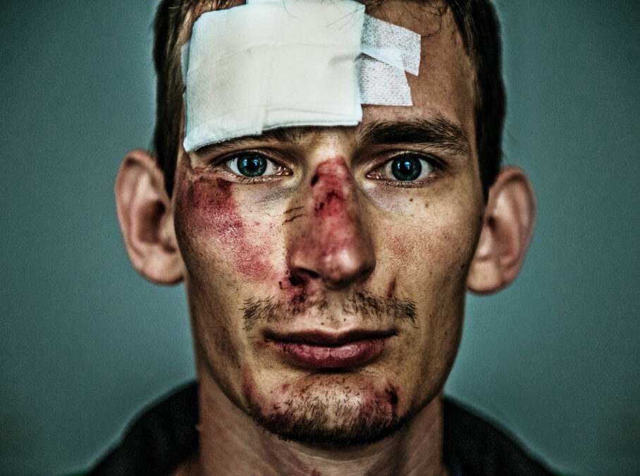 Victime d’un accident, je ne peux plus travailler comme avant: quels sont mes droits ?